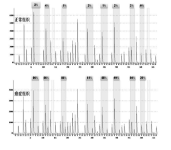 宫颈癌基因甲基化筛查诊断标志物试剂盒